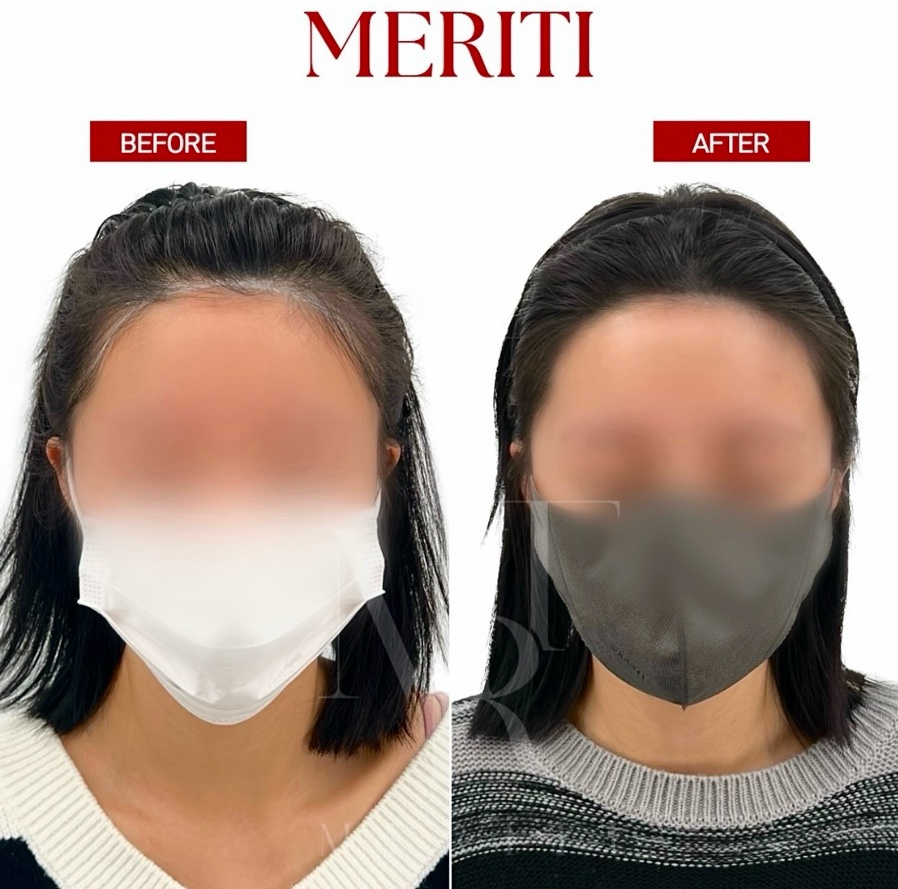 헤어팡팡&가발 이미지