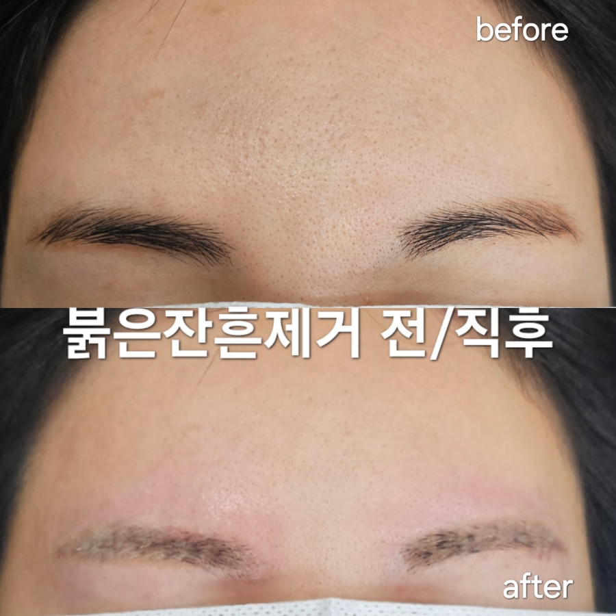 일일구헤어 이미지