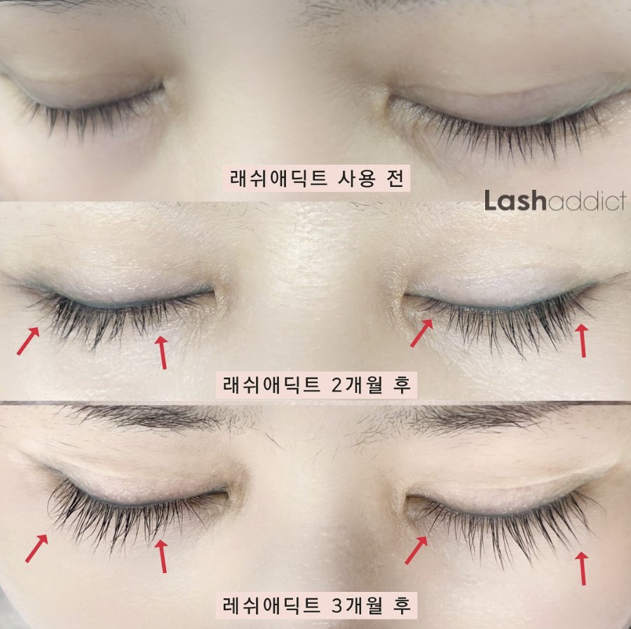 리얼래쉬 이미지