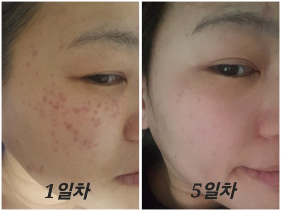 썸블리의원 이미지