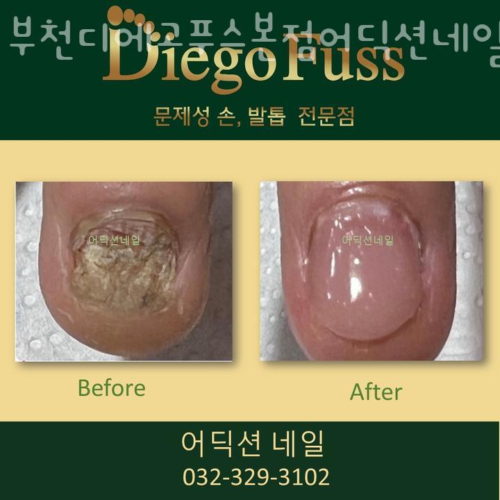 부천디에고푸스본점어딕션네일&풋케어전문 이미지