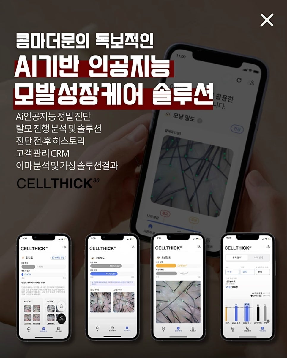 두피명가 이미지