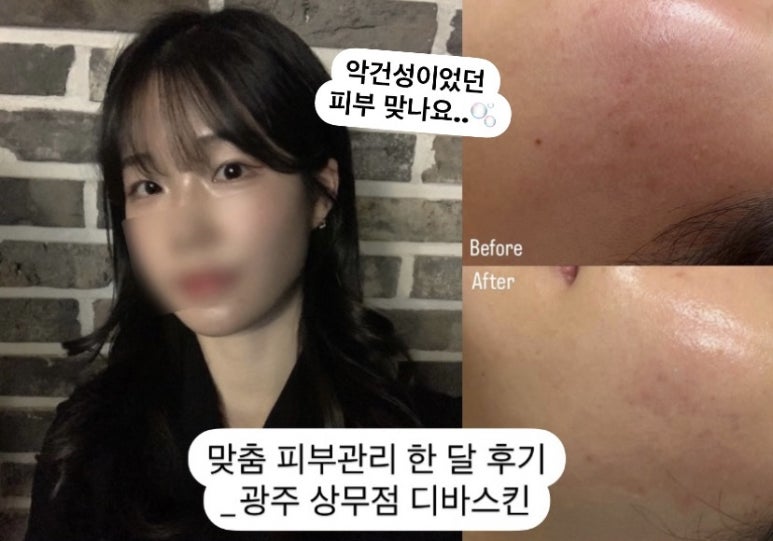 광주상무점 디바스킨 이미지
