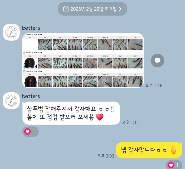 배럴스두피탈모센터 이미지