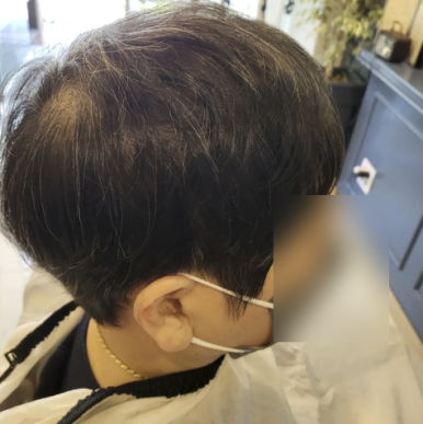 모두스가발 이미지