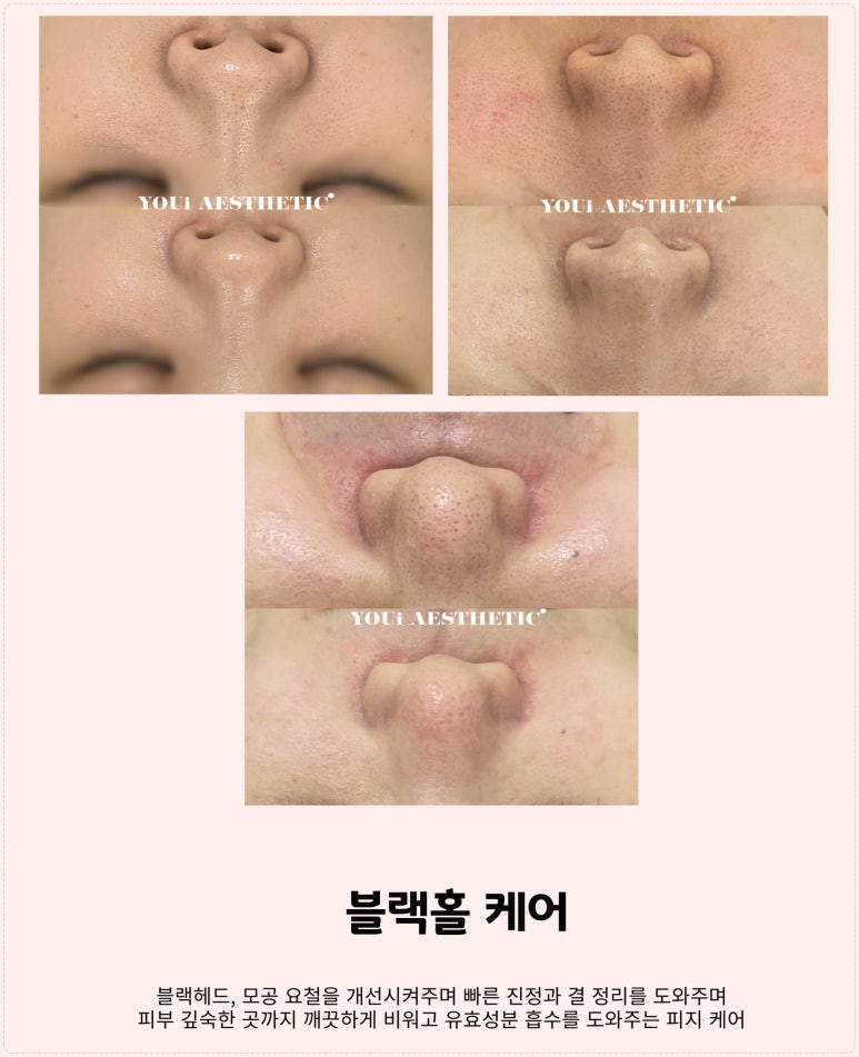 유아이에스테틱 이미지