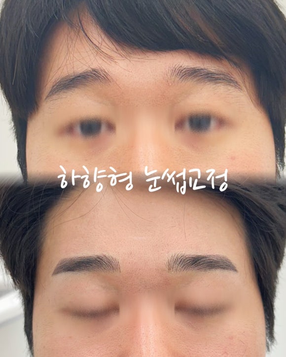 플람로우 이미지