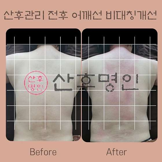 산후명인 이미지