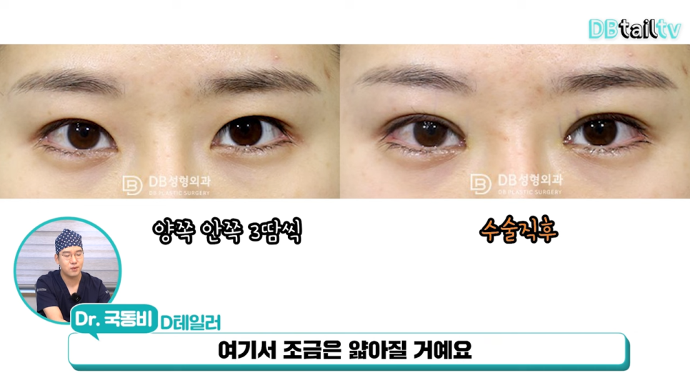 한땀차이 이미지