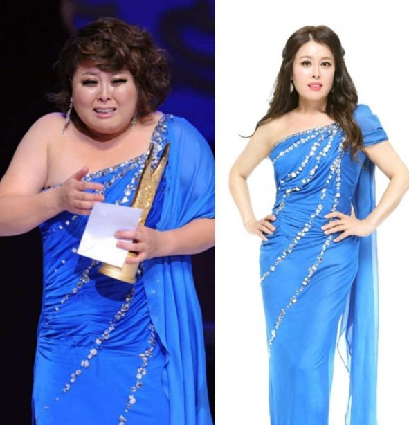 머슬브로짐 이미지