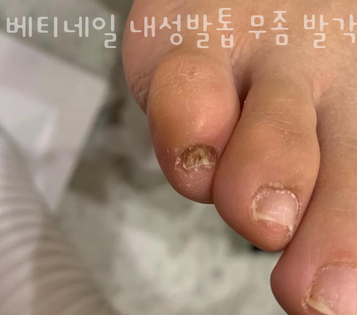 베티네일 이미지
