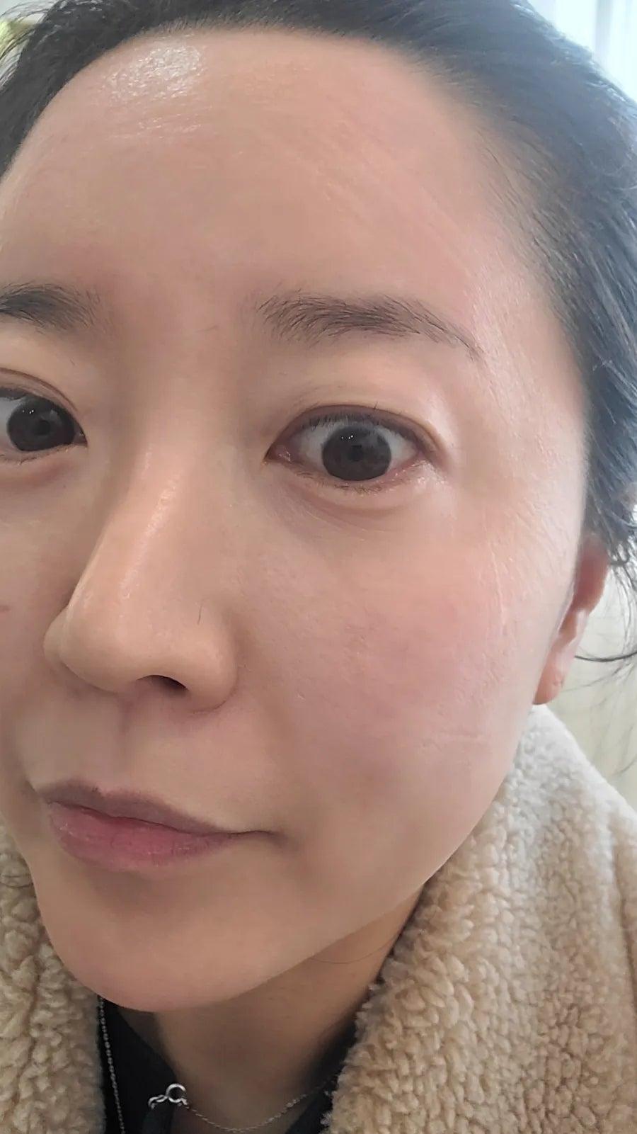 라즈베리뷰티 이미지
