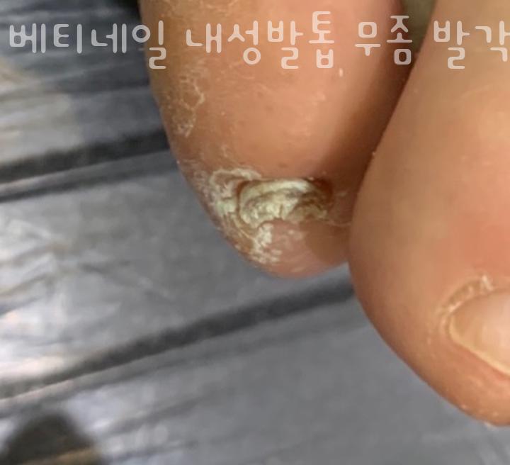 베티네일 이미지