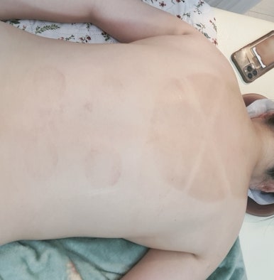 라즈베리뷰티 이미지