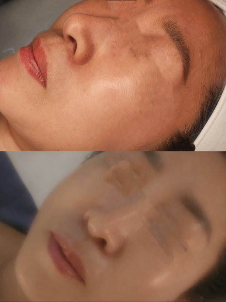 터치피부샵 이미지