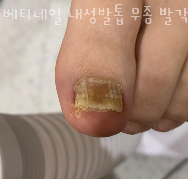 베티네일 이미지