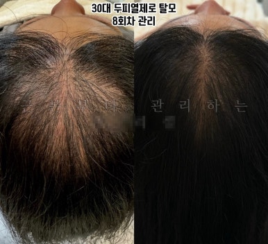 에이치리셀 이미지
