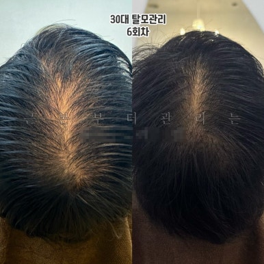 에이치리셀 이미지