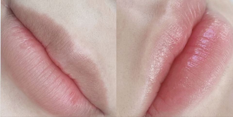 리즈뷰티 이미지