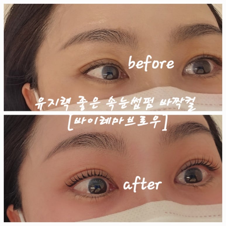 바이레마 이미지