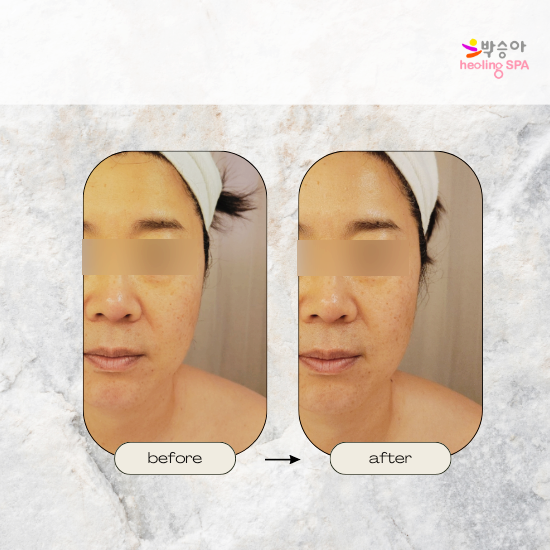 박승아 힐링스파 이미지