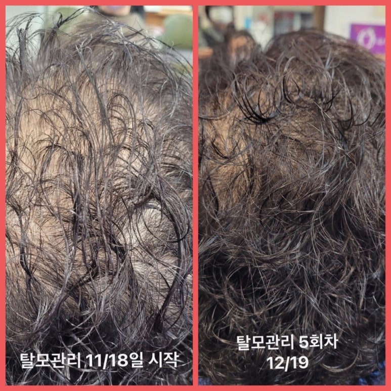 비벌리스킨케어 이미지