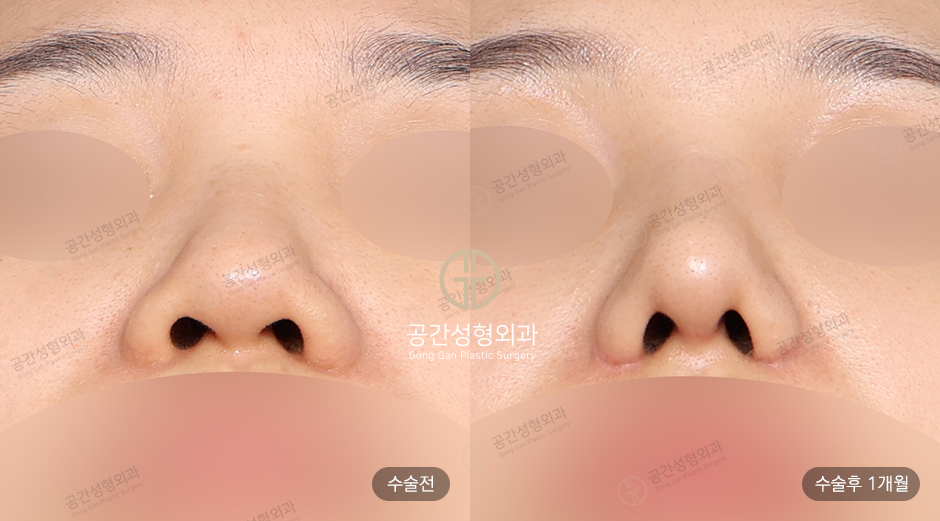 케이스코 이미지