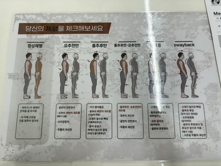 밸런스도수체형센터 이미지
