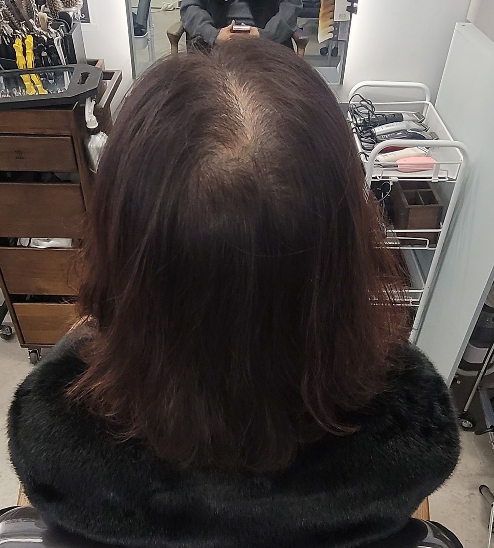 탑커버링 이미지