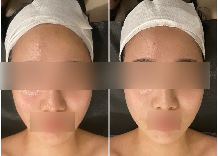 퓨어스킨앤바디 이미지