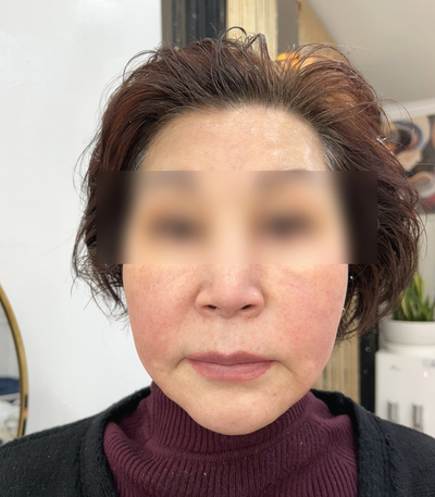 신다팩 이미지
