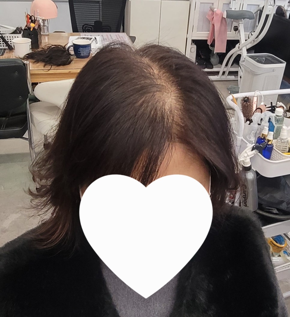탑커버링 이미지