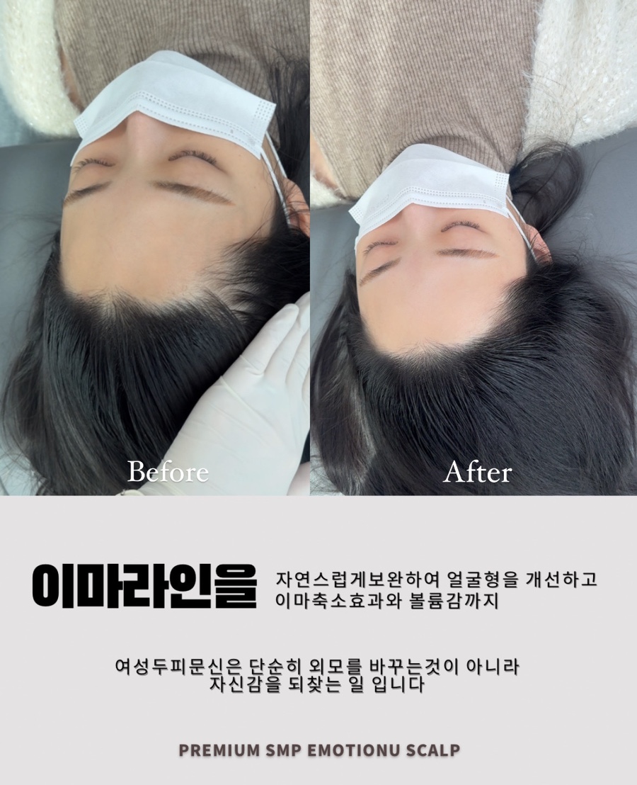 이모션유 이미지