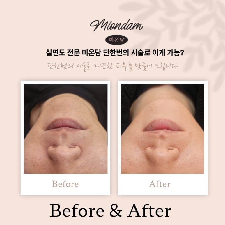 미온담 이미지