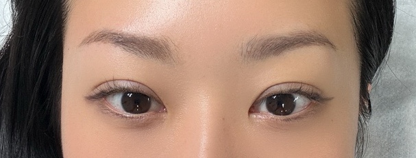 비니래쉬앤뷰티 이미지
