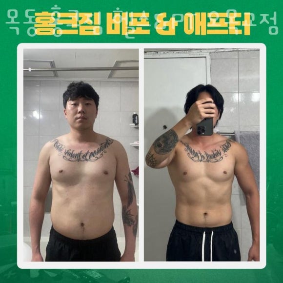 홍크짐 이미지