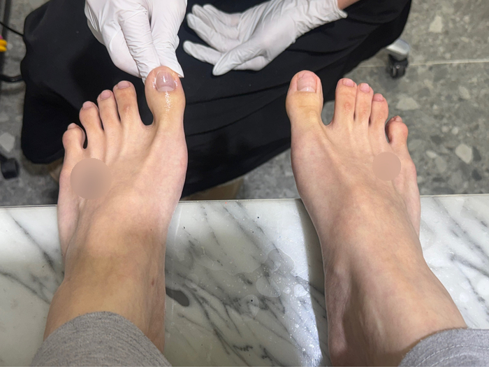 한센스네일 이미지