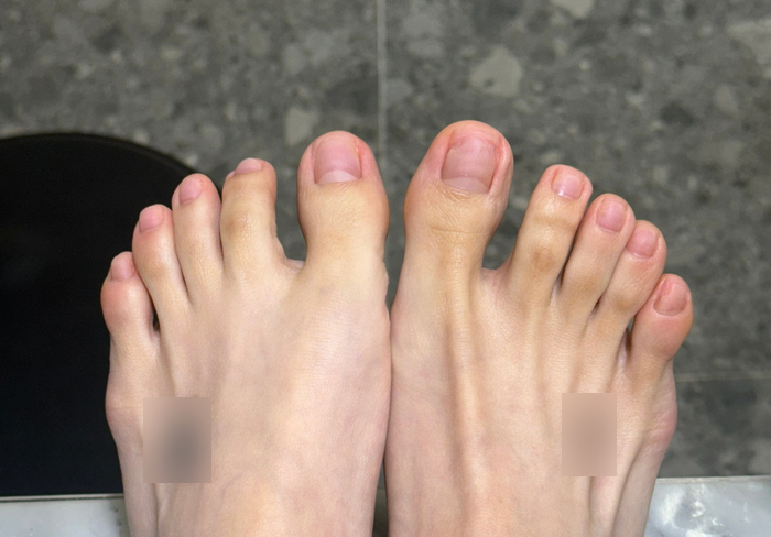 한센스네일 이미지