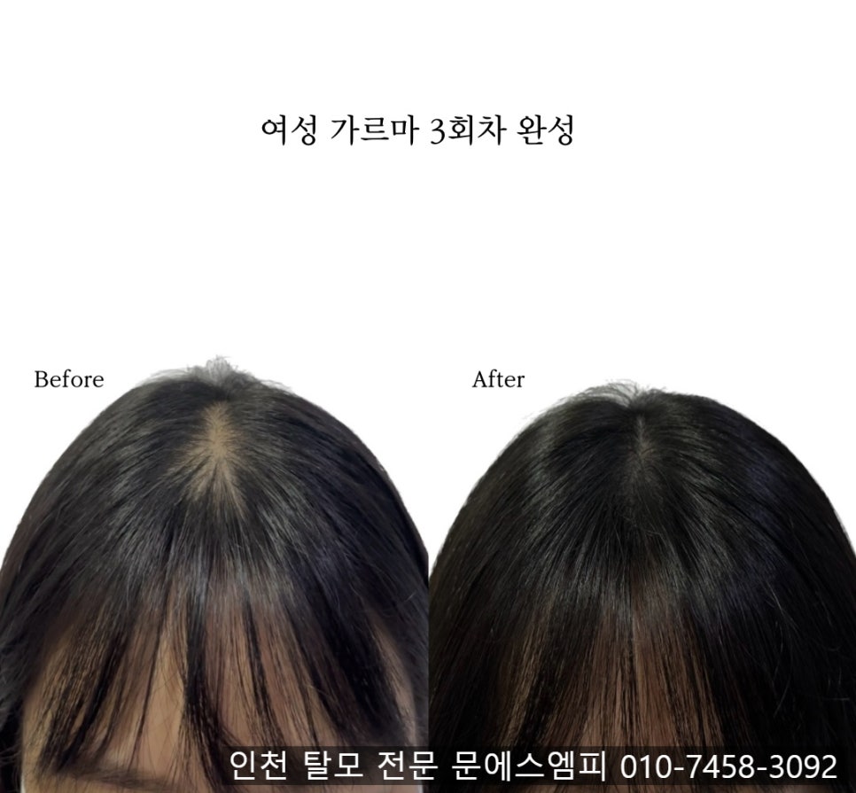 밝은조명 이미지