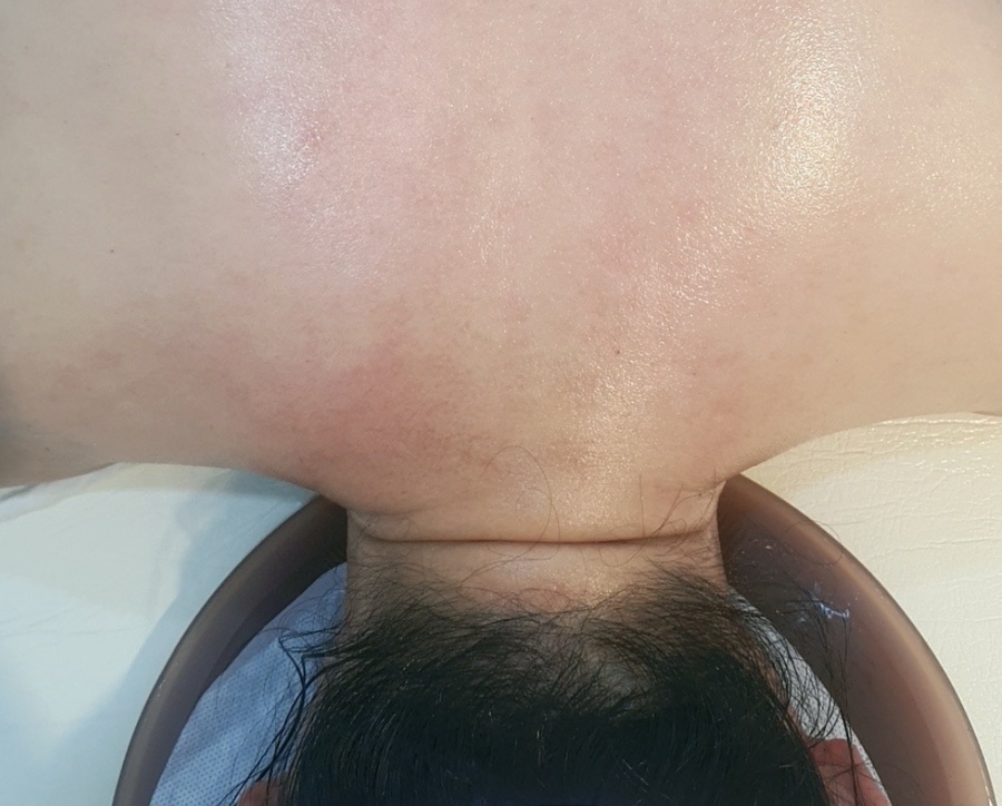 라즈베리뷰티 이미지