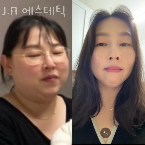 에스테틱J 이미지