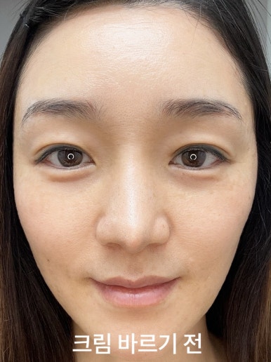 블로즈 이미지