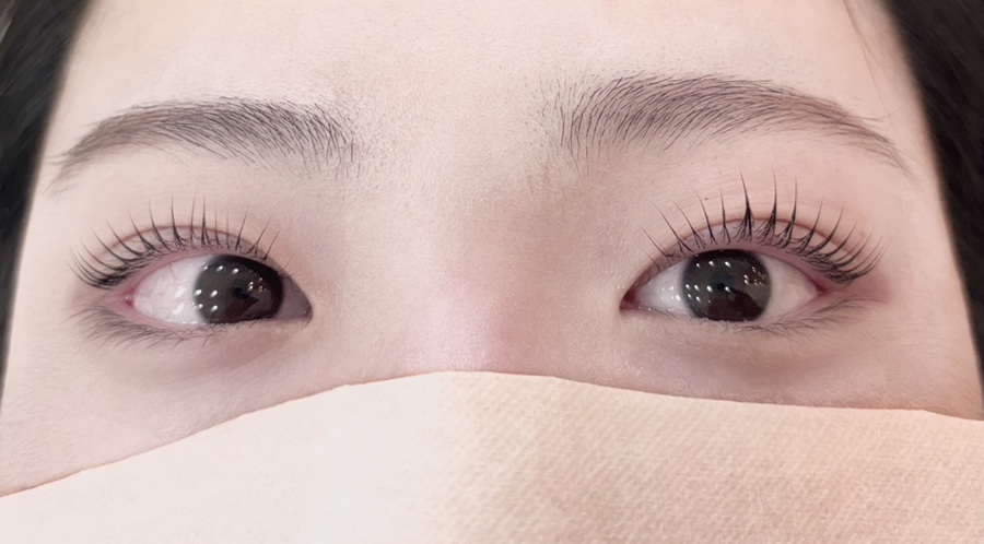 올단 이미지