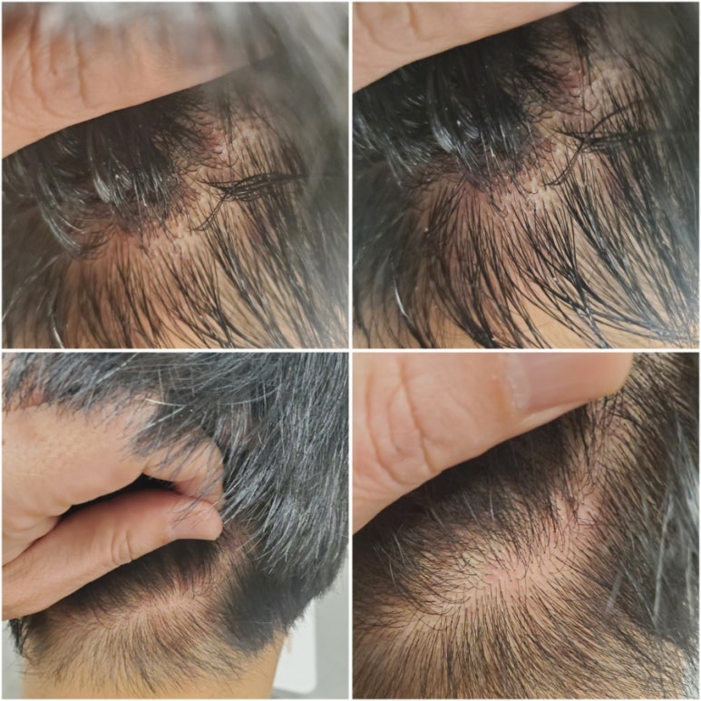 숲칼프가산두피탈모전문센터 이미지