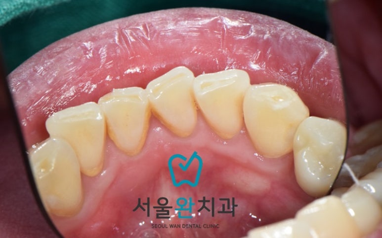 서울완치과 이미지