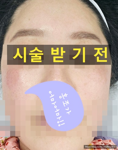 더마트리아 이미지
