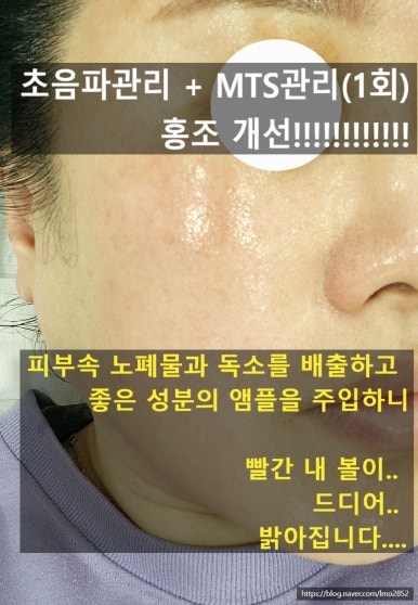 더마트리아 이미지
