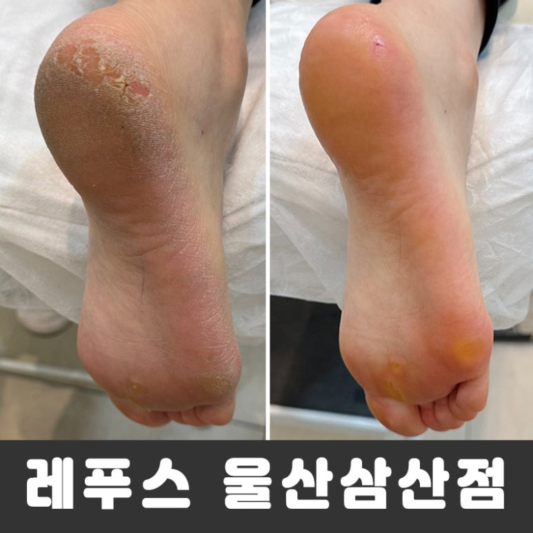레푸스울산삼산점 이미지