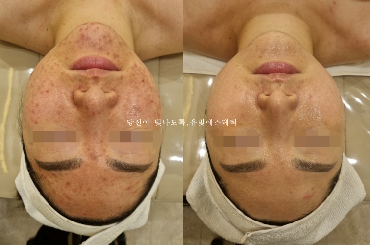 유빛 이미지