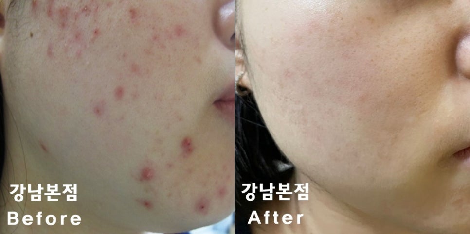 리유 이미지